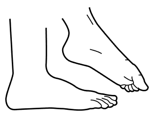 Step 1