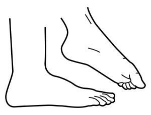 Step 1
